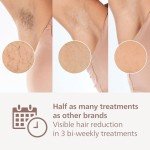 Philips Lumea 9900 Series IPL Hair Removal Device