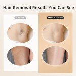 IPL Hair Removal Device with 3-in-1 Function