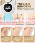Evolpor IPL Hair Removal Device with 999,999 Flashes