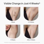 Ulike Air 2 Sapphire IPL Hair Removal Device