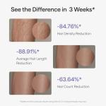 Ulike Air 3 Deluxe IPL Hair Removal Device