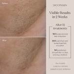 SmoothSkin Pure Adapt IPL Hair Removal Device