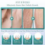 IPL Laser Hair Removal Device with Ice Cooling