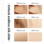 Sadodo IPL Hair Removal Device with Cooling System