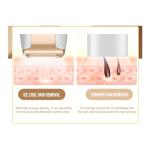 Layhou IPL Hair Removal Device with Cooling System