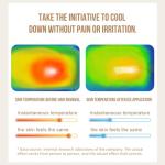 Layhou IPL Hair Removal Device with Cooling System