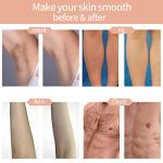 IPL Hair Removal Device for Face and Body