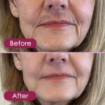 Face Epilator and Hair Remover for Smooth Skin