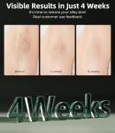 IPL Hair Removal Device with Unlimited Flashes