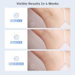 IPL Hair Removal Device with 999,900 Flashes