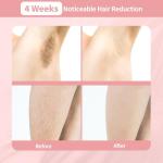 IPL Hair Removal Device for Home and Salon Use