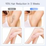 IPL Hair Removal Device for Smooth, Painless Skin