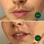 Nad's Facial Wax Strips for Women - 20 Strips