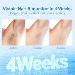 MLAY IPL Hair Removal Device with Ice Cooling