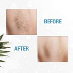 Clean + Easy Deluxe Home Electrolysis System