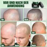 Bald Head Moisturiser and Scalp Cream for Men