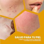 Soothing Propolis Gel for After-Shave Relief