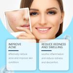 Retinol Gel for Acne and Blemish Treatment