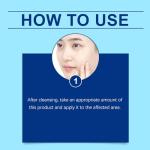 Retinol Gel for Acne and Blemish Treatment