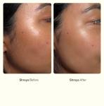 Nimbi Dermaplaner Razor Set for Hair Removal