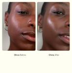 Nimbi Dermaplaner Razor Set for Hair Removal