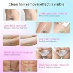 Gentle Hair Removal Cream for Sensitive Skin