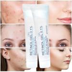 Retinol Gel for Acne and Skin Soothing