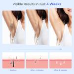 Deplite IPL Hair Removal Device with Cooling System