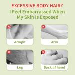 Electric Foot File and Dead Skin Remover