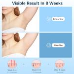 IPL Hair Removal Device with Ice Cooling Technology