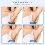 MLAY IPL Hair Removal Device with Cooling Technology