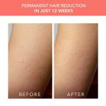 FOREO Peach 2 Go IPL Hair Removal Device