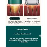 Luxe K IPL Hair Removal Device - Painless & Adjustable