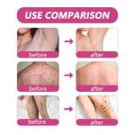 Hairerase Gentle Facial Hair Removal Cream