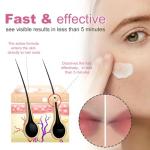 Natural Hair Removal Cream for Sensitive Skin