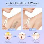 Painless IPL Hair Removal Device for Smooth Skin