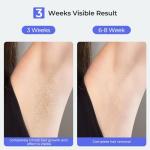 SALLOOT IPL Laser Hair Removal Device for All