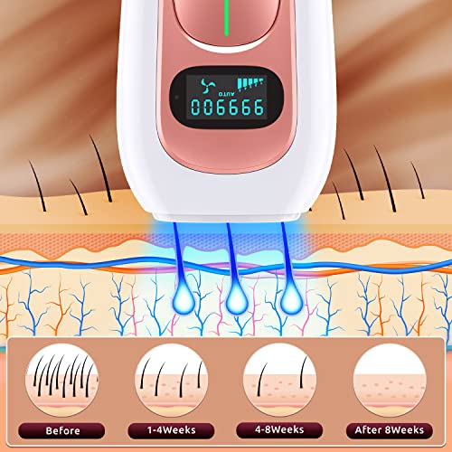 At-Home IPL Laser Hair Removal Device