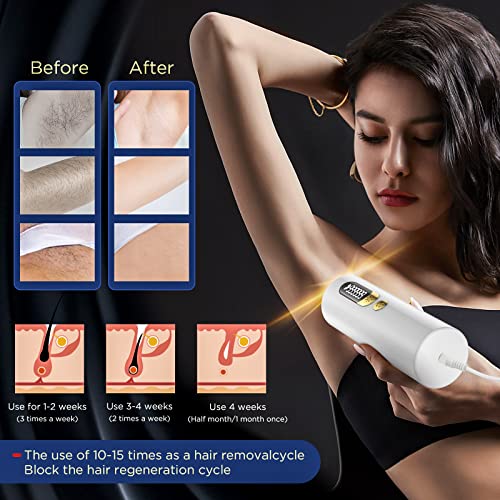 Permanent IPL Laser Hair Removal for Home Use