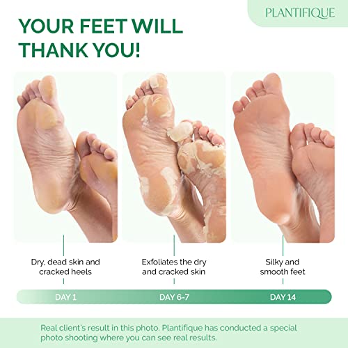 Plantifique Foot Peel Mask for Soft, Smooth Feet