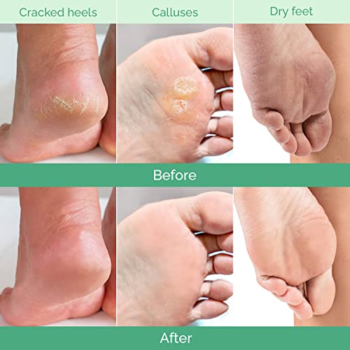 Plantifique Foot Peel Mask for Soft, Smooth Feet