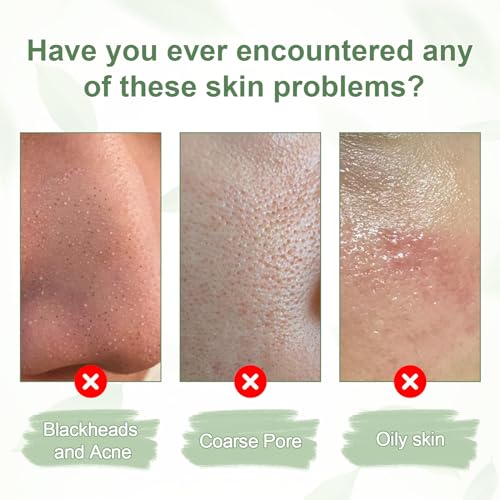 Green Tea Mask Stick for Deep Cleansing