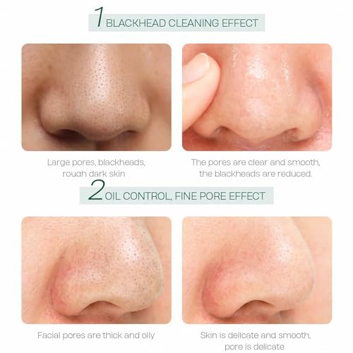 Organic Tea Tree Clay Mud Mask Set - 10 Pack