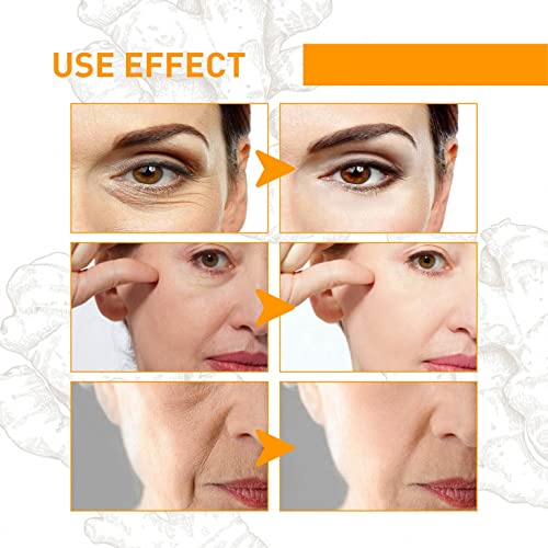Turmeric Skin Care Set for Dark Spot Correction