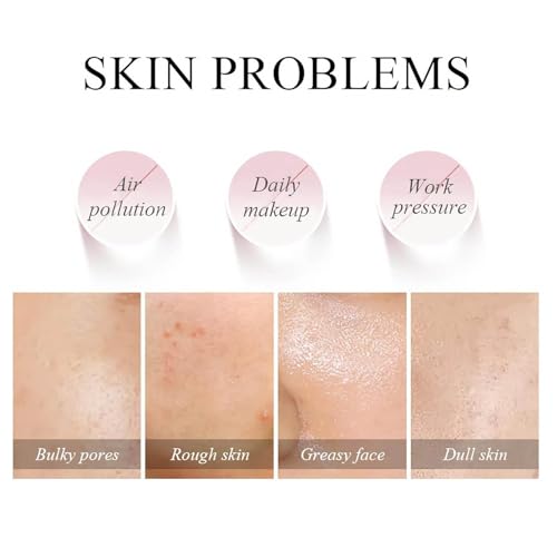 ILOVMUP 6-Pack Vegan Clay Mud Masks Set