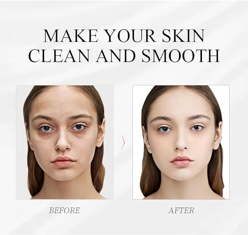 ILOVMUP 6-Pack Vegan Clay Mud Masks Set