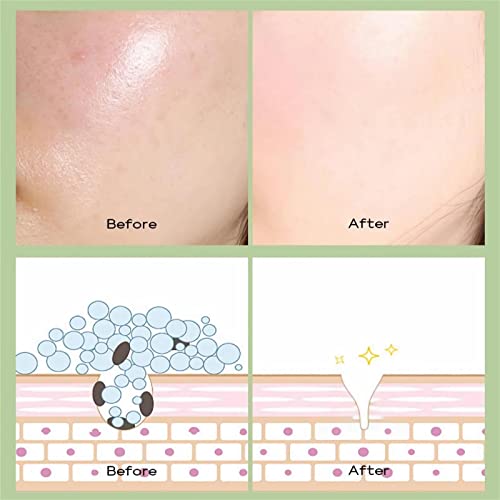 10 PCS Green Tea Detoxifying Clay Masks