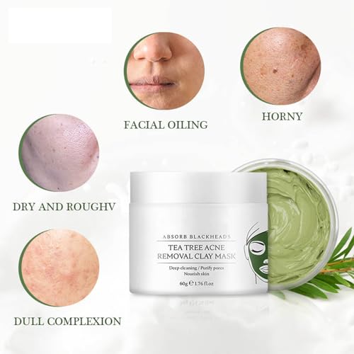 Tea Tree Acne Clay Mask - Deep Cleansing Mud