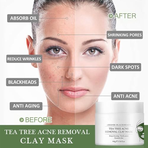 Tea Tree Acne Clay Mask - Deep Cleansing Mud