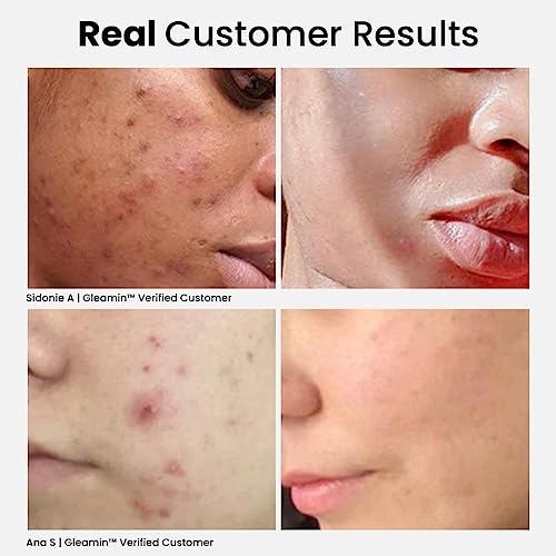Gleamin Vitamin C Mud Mask for Skin Imperfections